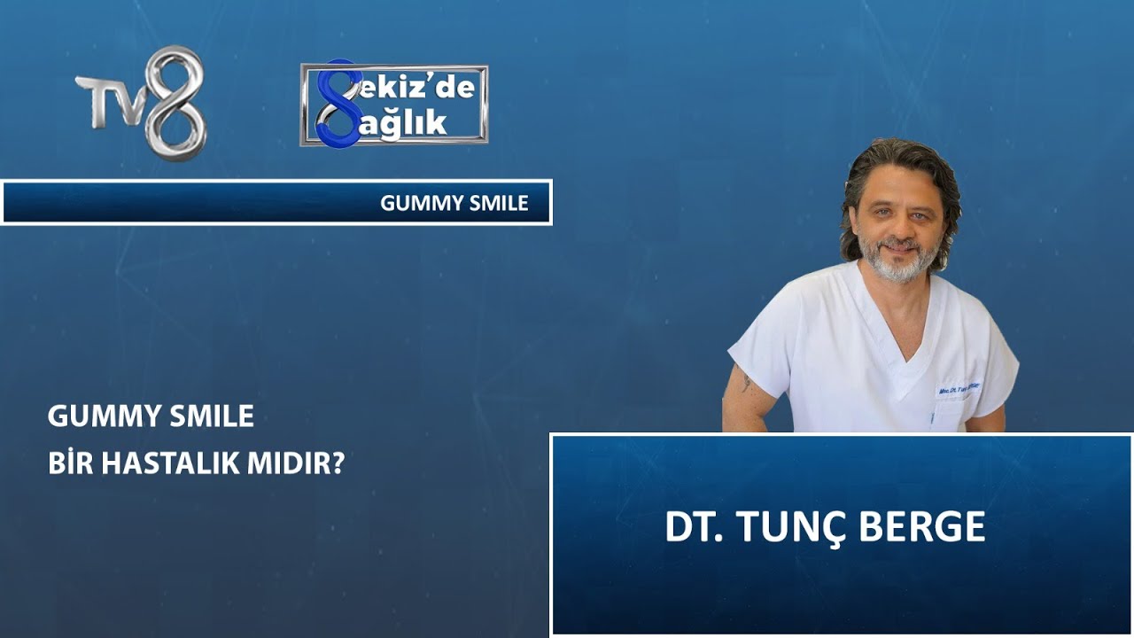 What is the Gummy Smile?
