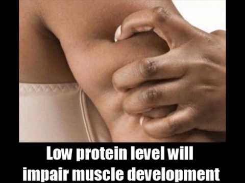 how to cure protein s'deficiency