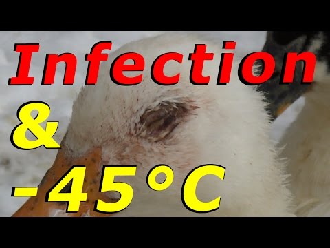 how to cure eye infection
