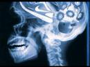 Brain File