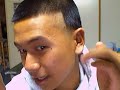 Hairline failure