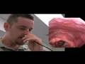 Nasoendoscopy from New Zealand