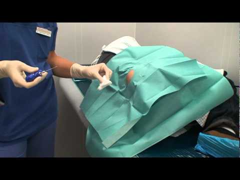 how to extract bone marrow for transplant