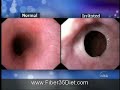 Acid Reflux Indigestion Heartburn Solutions Acid Reflux Indigestion Heartburn Solutions