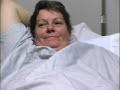 Peggy's breast reduction