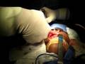 Leitinho das crianças I CIRURGIA MAXILO FACIAL