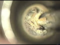 ear wax 3 ear wax 3