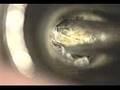 ear wax 3