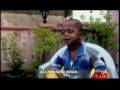 videos de Malattia Progeria