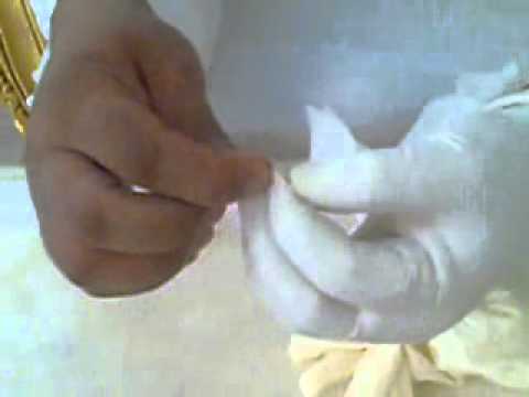 فك عقده من سحر في شعر