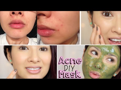 how to mask acne