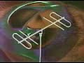 Antenne 2 - jingle mélancolies - 1978 Antenne 2 - jingle mélancolies - 1978