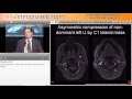YouTube - Prof. Dake's presentation on CCSVI part 2.