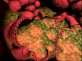 What is Pneumonia ? animation What is Pneumonia ? animation