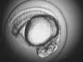 Zebrafish embryo development 1