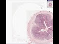 Histopathology Appendix--Normal with congestion Histopathology Appendix--Normal with congestion