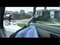 Very Bad Car Accident Injury