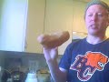 Spinal Muscular Atrophy - Amino Acid Diet - Part 2 of 3