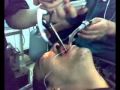 Endoscopy