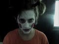 Anaf - Saw 2/3