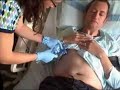 Umbilical Cord Blood Stem Cell Transplant - Part 1, The Unmanipulated Cells Umbilical Cord Blood