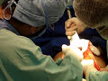 Redu��o de Abdomen