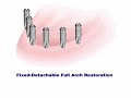 Fixed Detachable Full Arch Restoration (Fixed removable Denture)