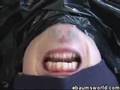 The Chins - Now your a man