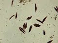 Blepharisma Conjugation