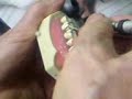 frf