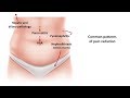 The Best 17 Pain In Left Side Of Lower Abdomen In Female