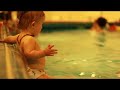 Down syndrome:&nbsp;Down Syndrom Sonea
