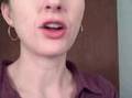 Invisalign - After The First 10 Min