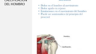 TERAPIA NATURAL PARA EL TRATAMIENTO DE LA CALCIFICACIÓN DEL HOMBRO