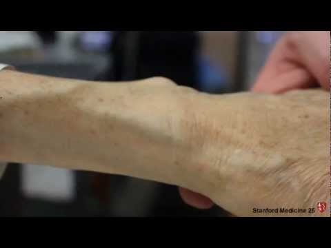 how to measure cvp video