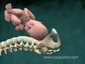 3D Medical Animation: Shoulder Dystocia Birth Injury