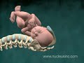 3D Medical Animation: Shoulder Dystocia Birth Injury