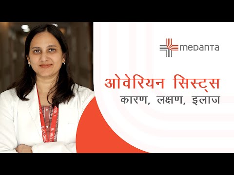 ओवेरियन सिस्ट्स – कारण, लक्षण, इलाज | 