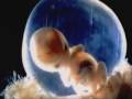 Embryo Entwicklung der Gliedmaßen (7)