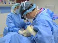 Beverly Hills Plastic Surgery- Breast Lift with Augmentation