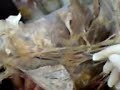 Anatomia Veterinaria Plexo Braquial