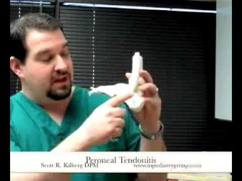 how to relieve outer foot pain