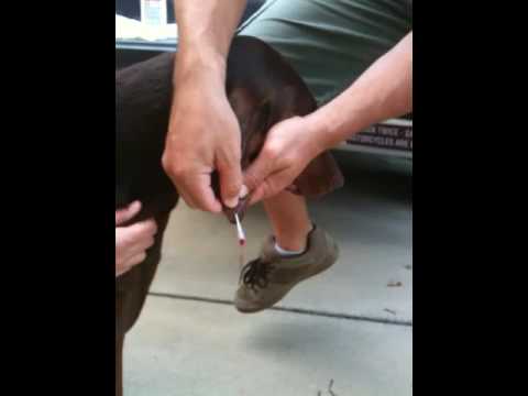 how to drain hematoma