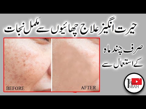 video-linktoworks-How to get rid of brown spot how to get rid from...