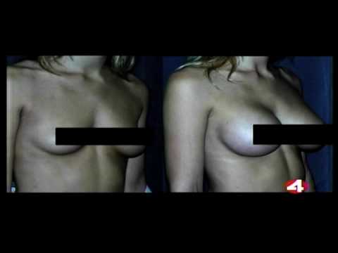 how to relieve pain after breast augmentation