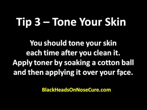 how to avoid blackheads