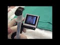 McGrath Video Laryngoscope - Clip 1 McGrath Video Laryngoscope - Clip 1