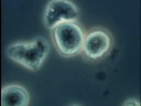IF Effect on Leukemic Cell(1) ????? IF Effect on Leukemic Cell(1) ?????