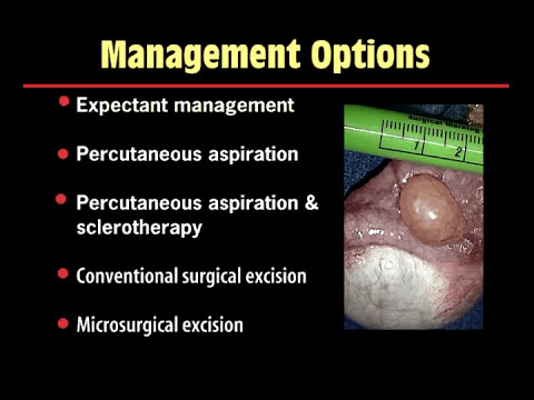 how to locate epididymis