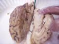 a-short-course-in-brain-surgery.html